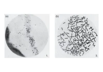 two black-and-white microscope images, one with a few black dots, the other with many rod-shaped bacteria two black-and-white microscope images, one with a few black dots, the other with many rod-shaped bacteria